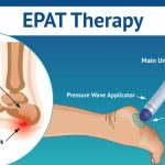 Unraveling What Is Epat: A Comprehensive Guide