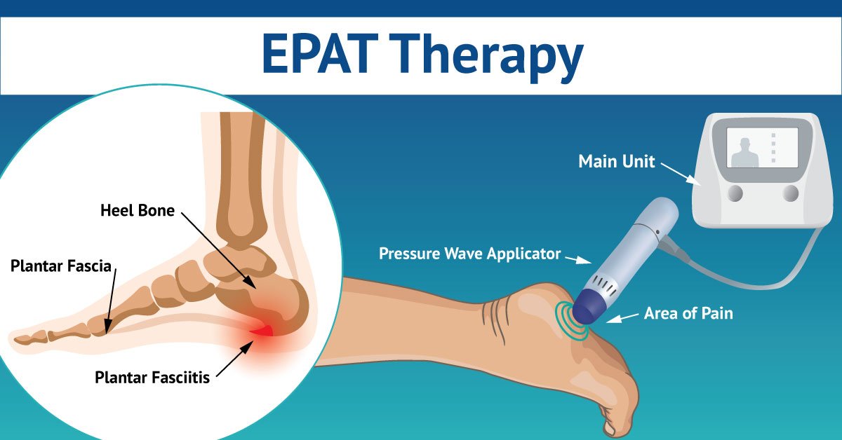 Unraveling What Is Epat: A Comprehensive Guide
